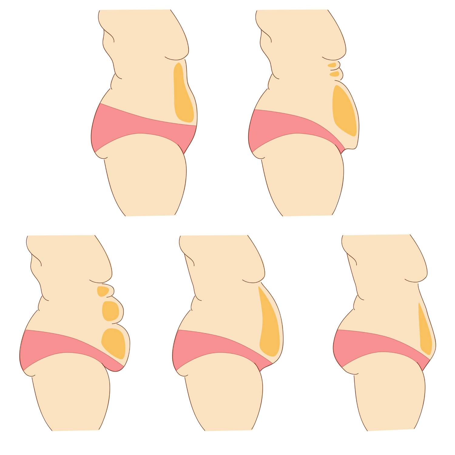 LynFit Cutting Edge